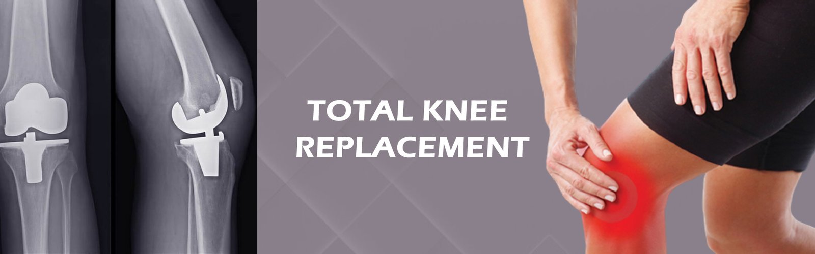 Total knee replacemennt copy11